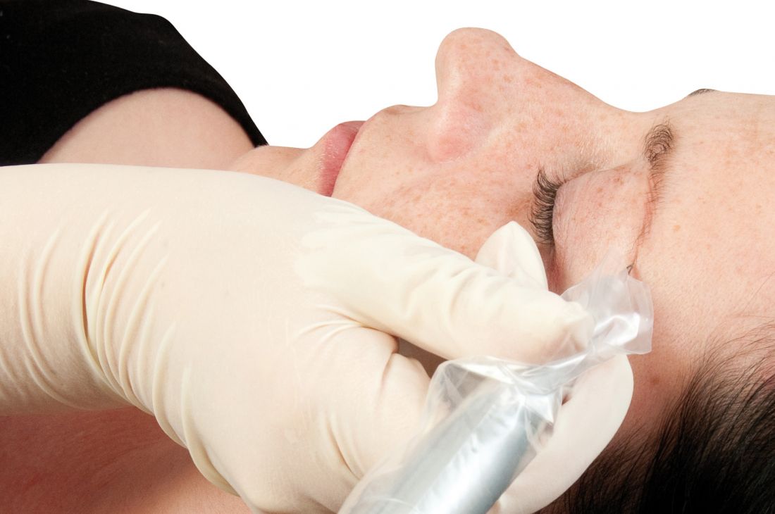 augenbrauen-entstehen-einzeichnen-permanent-make-up