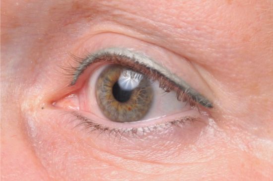 auffrischung-lidstrich-vorher-permanent-make-up