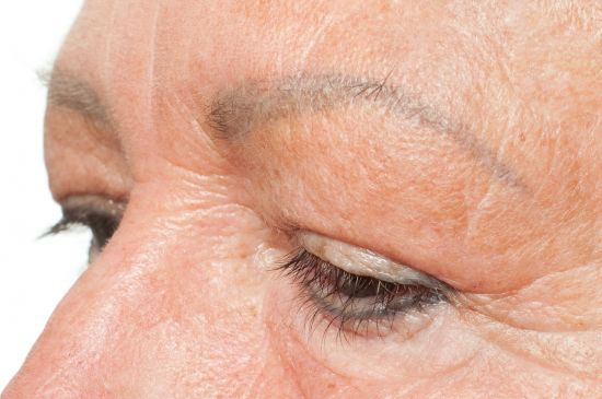 auffrischungen-augenbrauen-permanent.make-up-verblasst-alte-dame