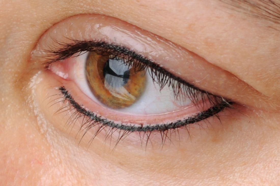 begeleiterscheinung-augenlider-geschwollen-permanent-make-up
