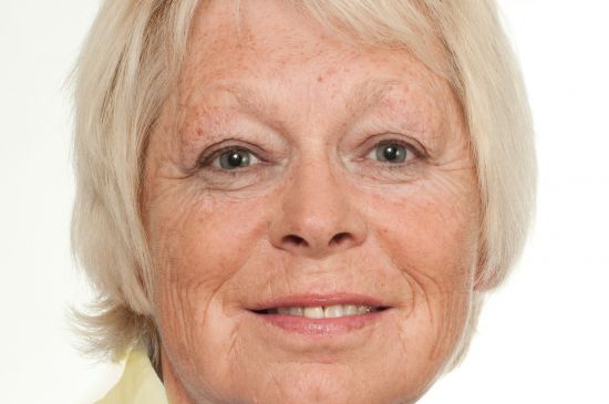 bestager-permanentmakeup-vorher-gesamteindruck