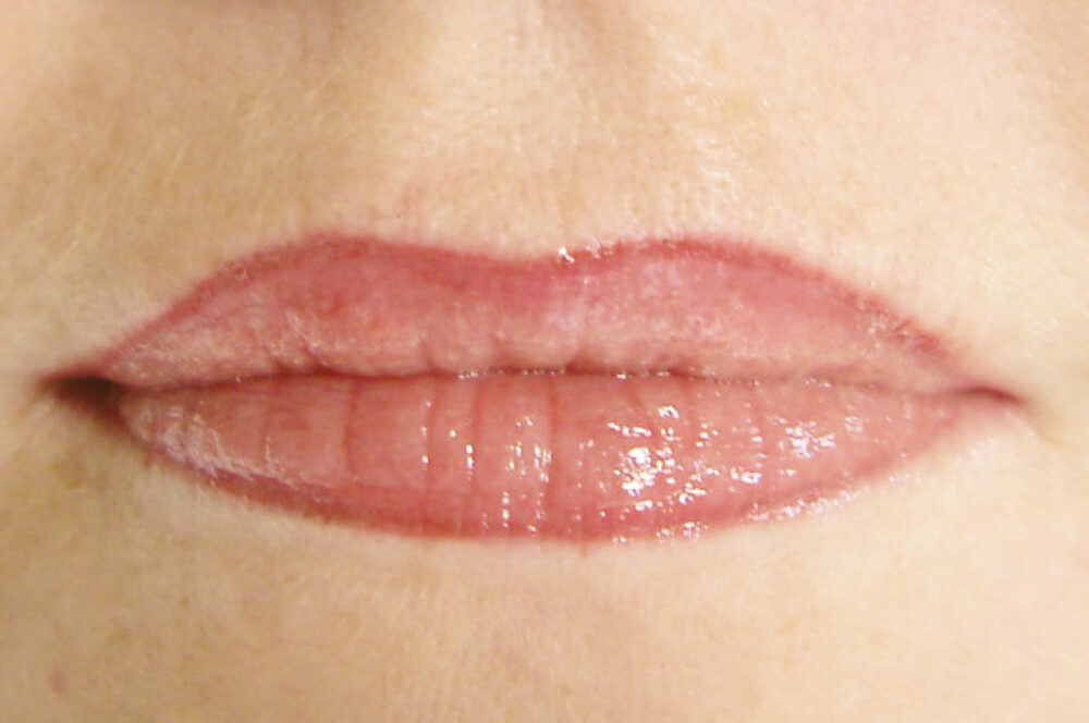 begleiterscheinung-lippen-dunkel-permanent-make-up