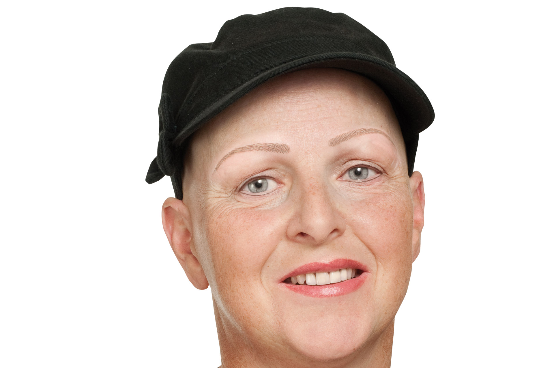 haarausfall-alopecia-areata-nachher-permanent-make-up.mit-hut