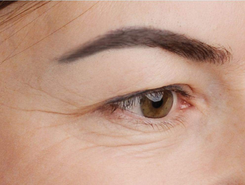korrektur-formschattierung-vorher-permanent-make-up