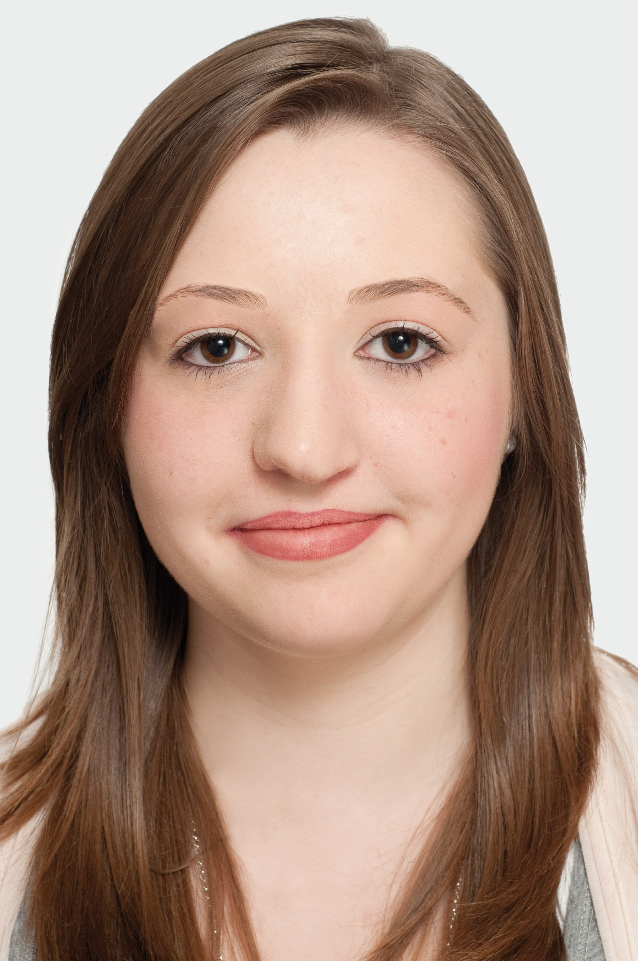 narben-lippenspalte-nachher-gesamteindruck-permanent-make-up